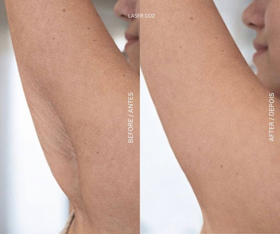Body Treatments treatment at AD Lisbon clinic