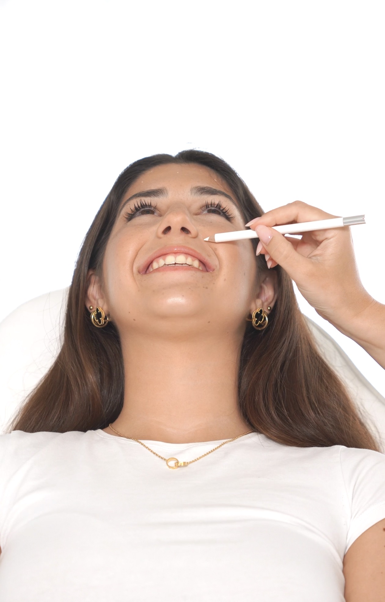 Tratamento para Rugas de Expressão treatment at AD Lisbon clinic